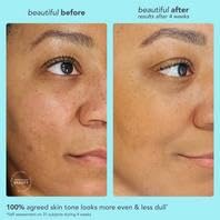 TULA Skin Care 24-7 Hydrating Day & Night Cream - Nourishing Moisturizer for Face, Maintain Skin Balance & Improve Skin Smoothness, Contains Watermelon & Apple Extract thumbnail 6