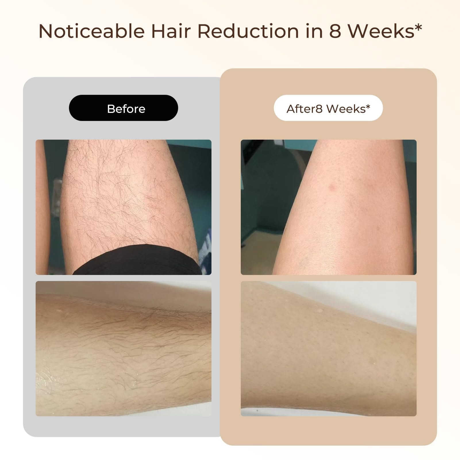 Laser Hair Removal, Laser IPL Hair Removal for Women and Men Permanent, Hair Removal Device with 3.0 IPL Red Light Wave, Home Laser Hair Removal Device for Legs Armpits Back Bikini Body Use - Image 6