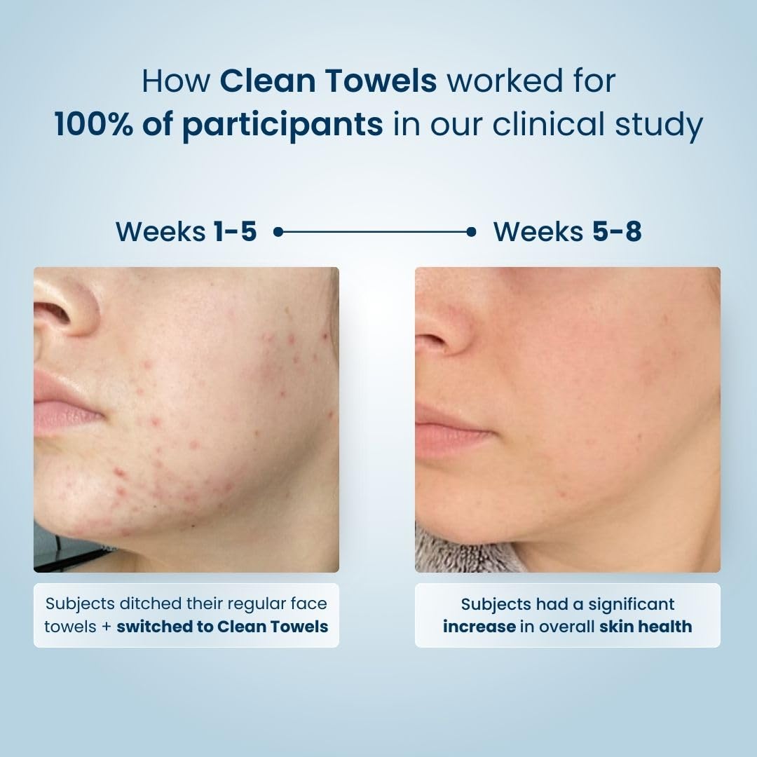 Clean Skin Club Clean Towels XL™, 100% USDA Biobased Face Towel, Disposable Face Towelette, Eczema Association Accepted, Makeup Remover Dry Wipes, Ultra Soft, 300 Ct, 6 Pack: 100 Count (Most Popular!)