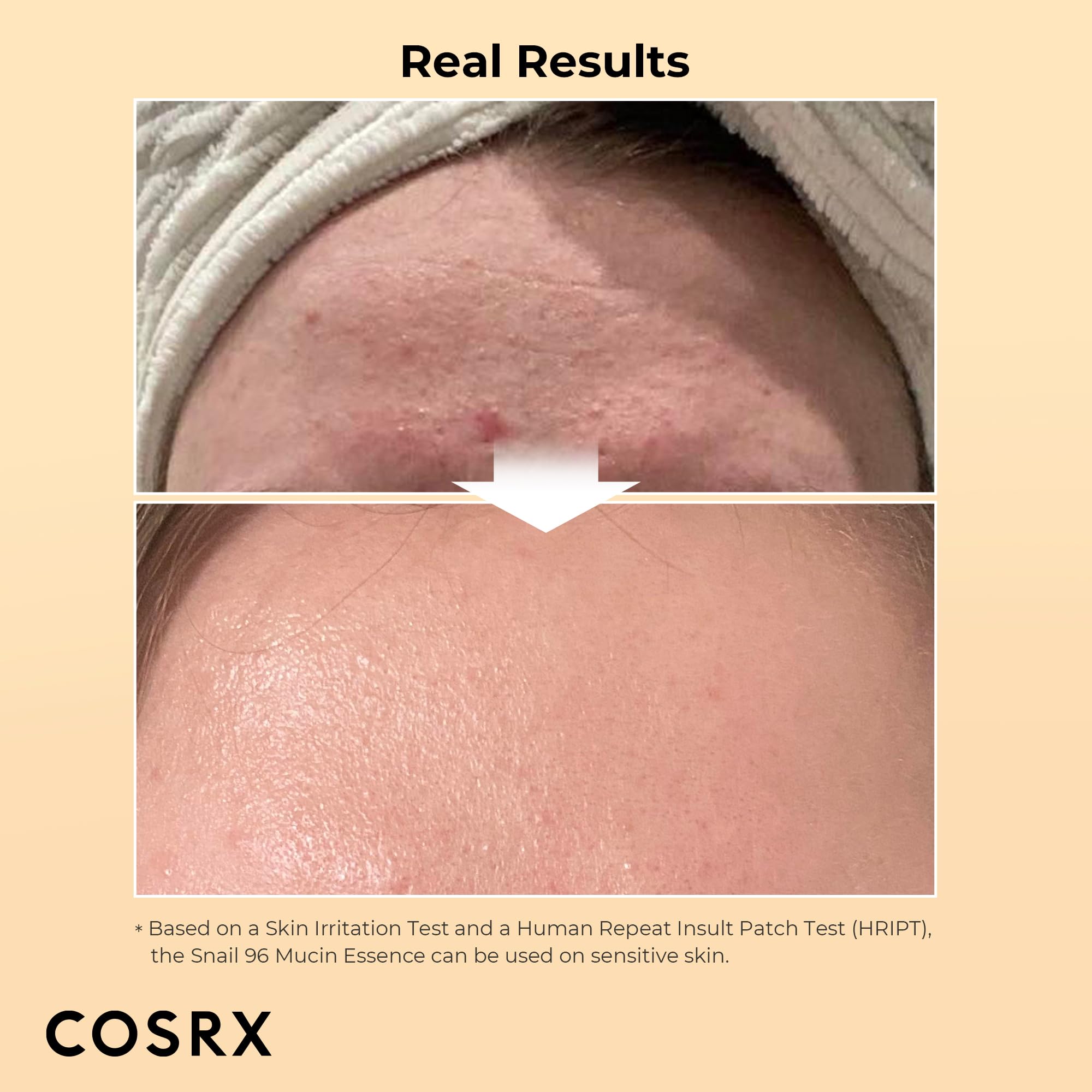 COSRX Snail Mucin 96% Power Repairing Essence 3.38 fl.oz 100ml, Hydrating Serum for Face with Snail Secretion Filtrate for Dull Skin & Fine Lines, Korean Skin Care: 3.35 Fl Oz (Pack of 1)