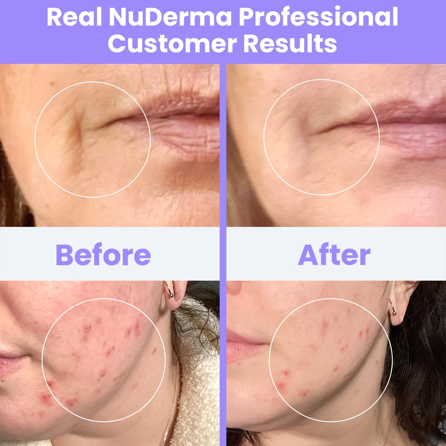 NuDerma Clinical Skin Therapy Wand - Portable Skin Therapy Machine w 6 Fusion Neon + Argon Wands – Anti Aging - Clarifying - Skin Tightening & Radiance - Wrinkle Reducing