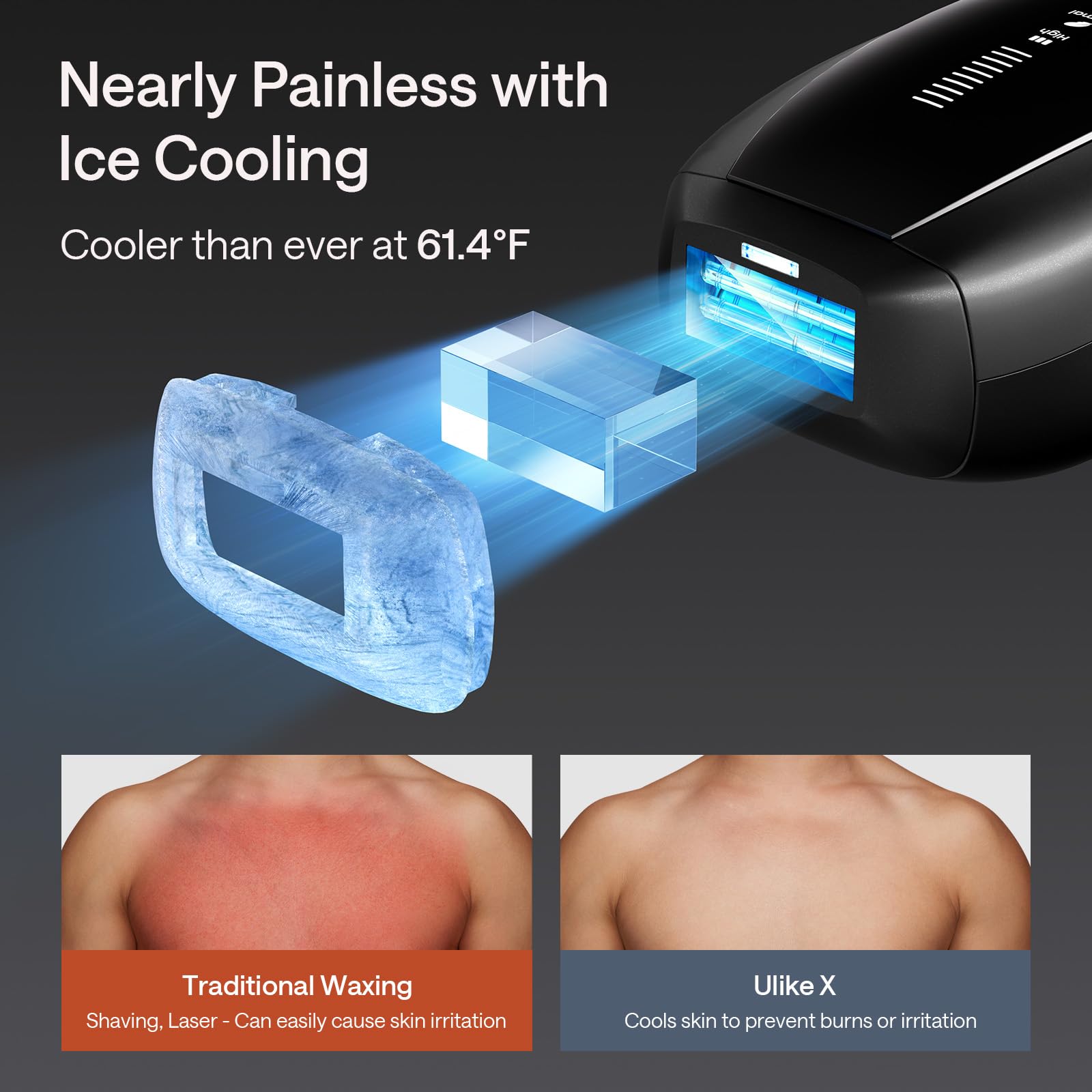 Ulike X IPL Hair Removal Device, Laser Hair Removal with Ice-Cooling, Dual Lights & Skin Senor for Nearly Painless & Long-Lasting Hair Removal, 3 Modes Tailored for Stubborn Hair, Gift for Smooth Skin thumbnail 4