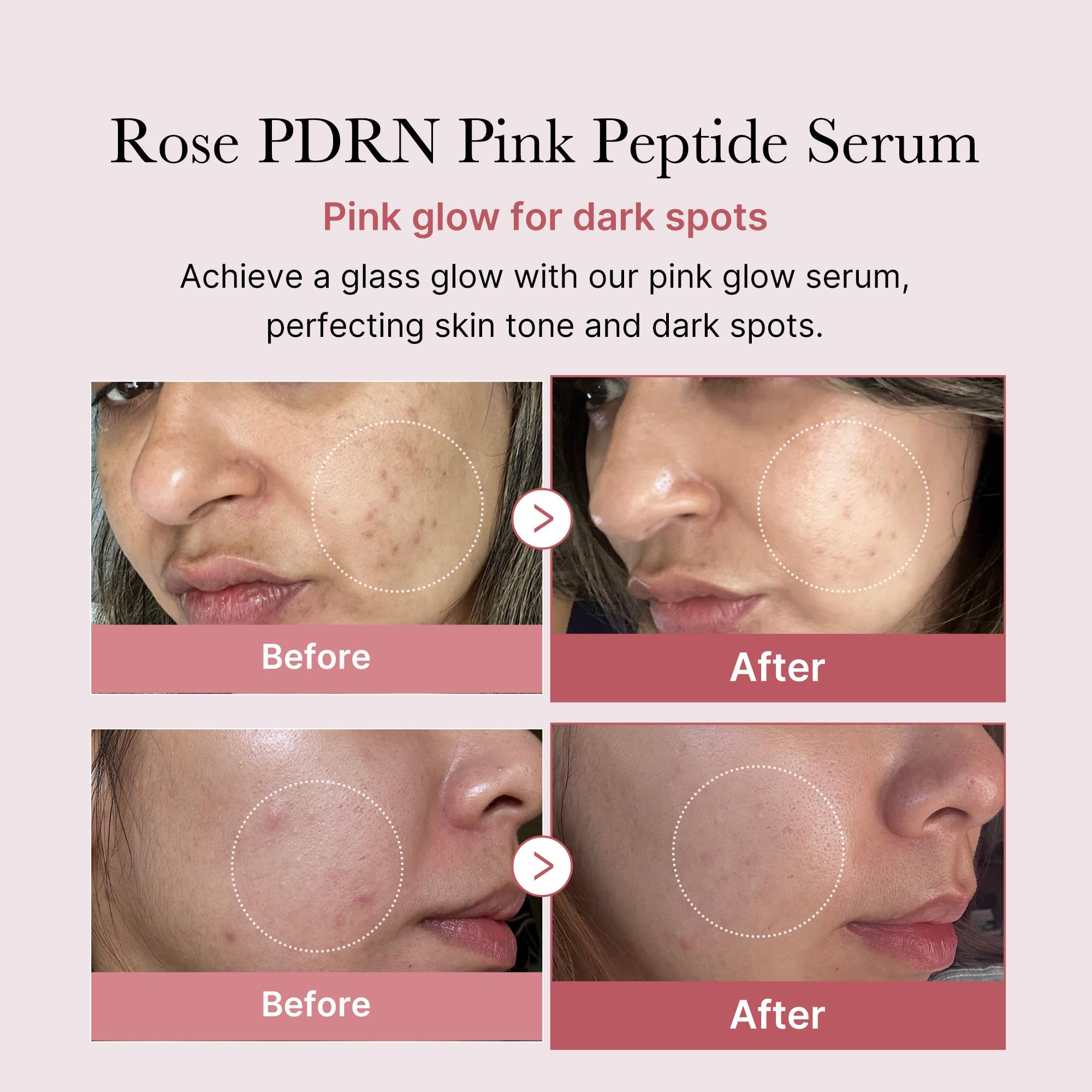medicube Salmon DNA PDRN Pink Peptide Serum, Pink glow serum, Peptide, Niacinamide, Hydrating & Moisturizing & Firming, Uneven Skin Tone, Korean Skincare | 1.01 fl.oz. (1.01 fl.oz., Salmon DNA PDRN): Rose PDRN (Vegan) 1.01 Fl Oz (Pack of 1)