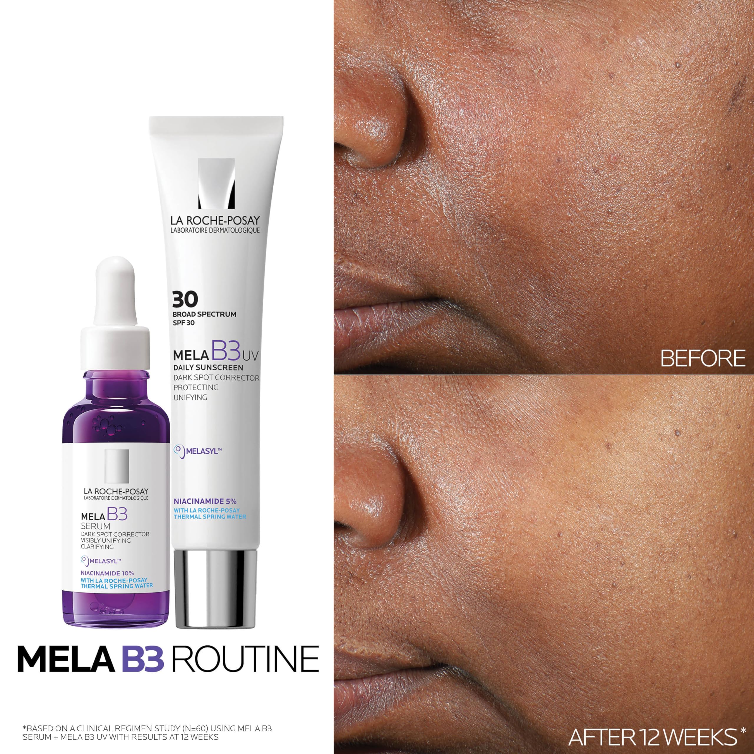 La Roche-Posay Mela B3 Serum, Dark Spot Corrector With Anti-Aging Melasyl + 10% Niacinamide, Discoloration Correcting Serum for Sun Spots, Age Spots & Post-Acne Marks: 1 Fl Oz (Pack of 1)